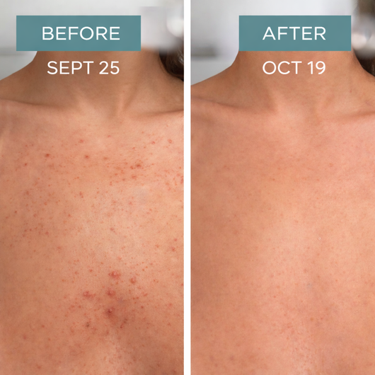 Havenley Health Refining Body Serum